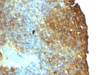Immunohistochemistry-Paraffin: Moesin Antibody (SPM562) [NBP2-32876]
