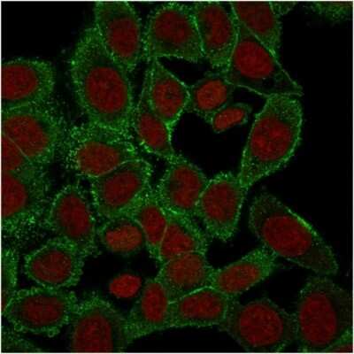 Immunocytochemistry/ Immunofluorescence: Moesin Antibody (rMSN/492) [NBP3-07218]