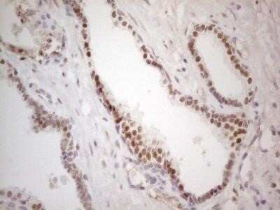Immunohistochemistry: Mohawk homeobox Antibody (OTI6B12) - Azide and BSA Free [NBP2-72758]