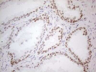 Immunohistochemistry: Mohawk homeobox Antibody (OTI6B12) - Azide and BSA Free [NBP2-72758]