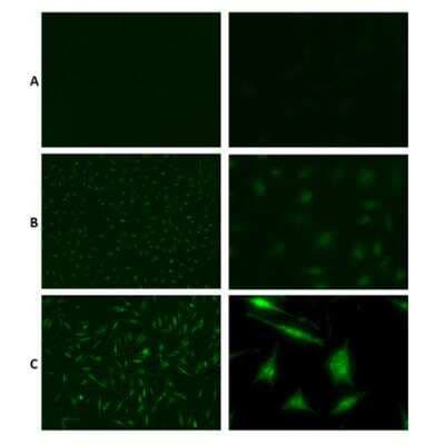 Immunocytochemistry/ Immunofluorescence: Mono- and polyubiquitinylated conjugates Antibody (UBCJ2) [NBP3-06879]