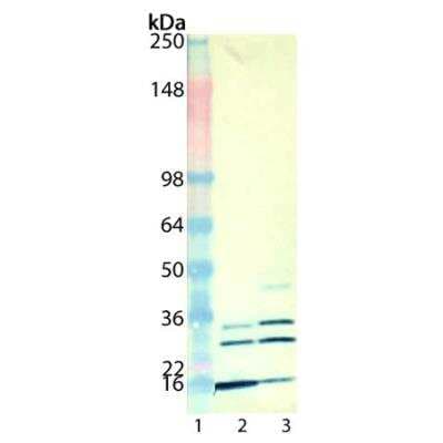 Western Blot: Mono- and polyubiquitinylated conjugates Antibody (UBCJ2) [NBP3-06879]