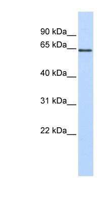 Western Blot: Monoamine Oxidase B Antibody [NBP1-59569]