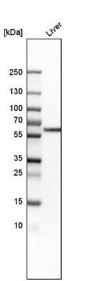 Western Blot: Monoamine Oxidase B Antibody [NBP1-87493]
