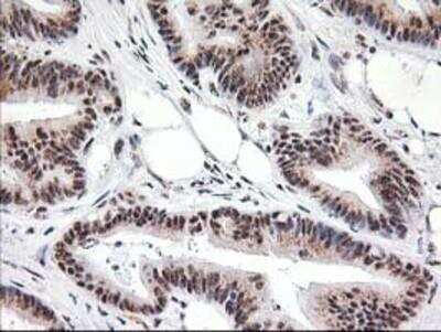 Immunohistochemistry-Paraffin: Monoglyceride Lipase Antibody (OTI2B11) [NBP2-00735]