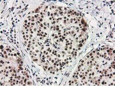 Immunohistochemistry-Paraffin: Monoglyceride Lipase Antibody (OTI2B11) [NBP2-00735]