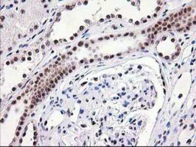 Immunohistochemistry-Paraffin: Monoglyceride Lipase Antibody (OTI2B11) [NBP2-00735]