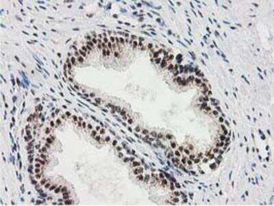 Immunohistochemistry-Paraffin: Monoglyceride Lipase Antibody (OTI2B11) [NBP2-00735]