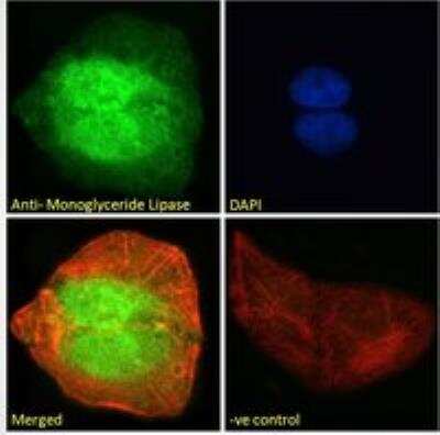 Immunocytochemistry/ Immunofluorescence: Monoglyceride Lipase Antibody [NB100-96920]