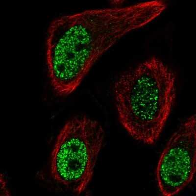 Immunocytochemistry/ Immunofluorescence: Monoglyceride Lipase Antibody [NBP2-55204]