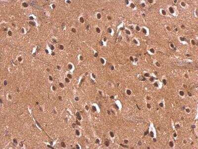 Immunohistochemistry-Paraffin: Monoglyceride Lipase Antibody [NBP2-19380]