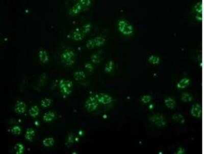 Flow Cytometry: Monoglyceride Lipase Antibody (OTI2B11) - Azide and BSA Free [NBP2-72759]