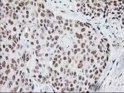 Immunohistochemistry: Monoglyceride Lipase Antibody (OTI2B11) - Azide and BSA Free [NBP2-72759]