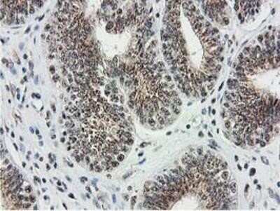 Immunohistochemistry: Monoglyceride Lipase Antibody (OTI2B11) - Azide and BSA Free [NBP2-72759]