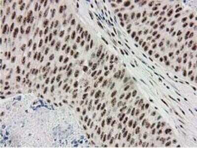 Immunohistochemistry: Monoglyceride Lipase Antibody (OTI2B11) - Azide and BSA Free [NBP2-72759]
