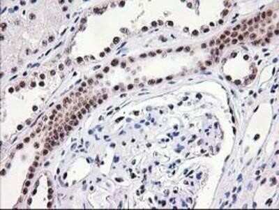 Immunohistochemistry: Monoglyceride Lipase Antibody (OTI2B11) - Azide and BSA Free [NBP2-72759]