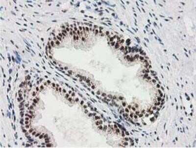 Immunohistochemistry: Monoglyceride Lipase Antibody (OTI2B11) - Azide and BSA Free [NBP2-72759]