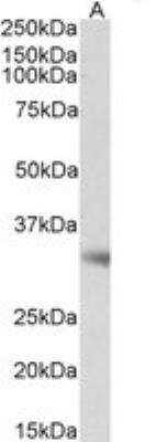 Western Blot: Monoglyceride Lipase Antibody [NB100-96920]