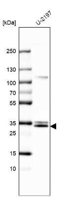 Western Blot: Monoglyceride Lipase Antibody [NBP2-55204]