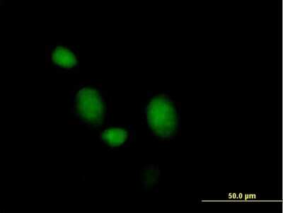 Immunocytochemistry/ Immunofluorescence: Morg1 Antibody [H00084292-B01P]