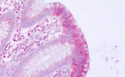 Immunohistochemistry-Paraffin: Motilin R/GPR38 Antibody [NBP3-14407]