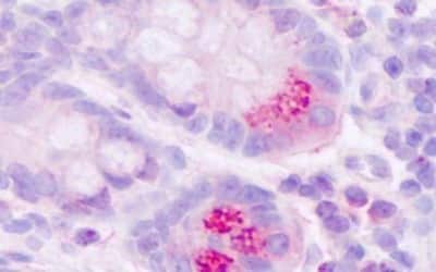 Immunohistochemistry-Paraffin: Motilin R/GPR38 Antibody [NBP3-14407]