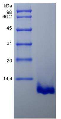 SDS-PAGE: Recombinant Mouse CCL22/MDC Protein [NBP2-35167]