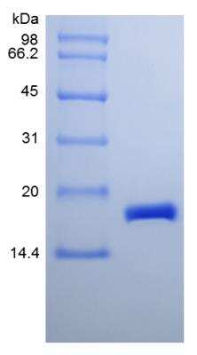 SDS-PAGE: Recombinant Mouse CDNF Protein [NBP2-35162]