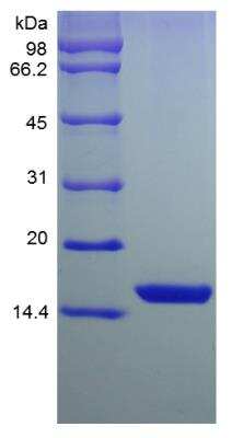 SDS-PAGE: Recombinant Mouse FGF acidic/FGF1 Protein [NBP2-35140]