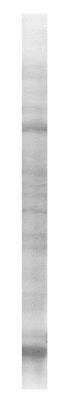 SDS-PAGE: Mouse Kidney Whole Tissue Lysate (Adult Whole Normal) [NB820-59661]