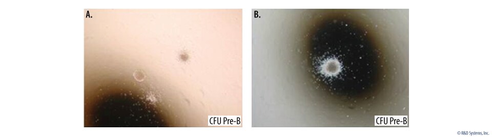 Mouse Pre-B Colony Formation. 