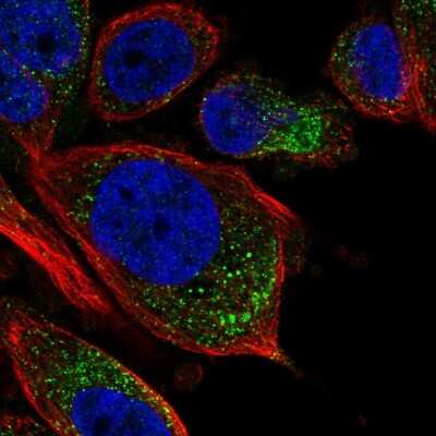 Immunocytochemistry/ Immunofluorescence: Mover Antibody [NBP2-55810]