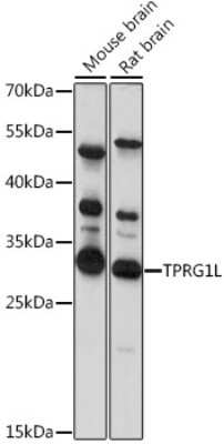 Western Blot: Mover AntibodyAzide and BSA Free [NBP2-94444]