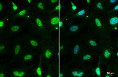 Immunocytochemistry/ Immunofluorescence: Mre11 Antibody (12D7) [NB100-473]
