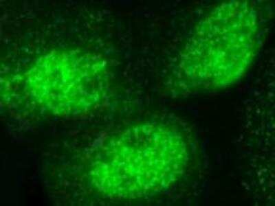 Immunocytochemistry/ Immunofluorescence: Mre11 Antibody (12D7) [NB100-473]