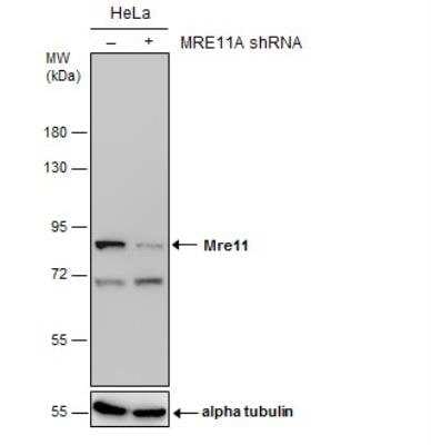 Knockdown Validated: Mre11 Antibody (12D7) [NB100-473]