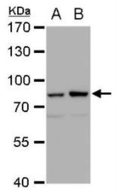 Western Blot: Mre11 Antibody (12D7) [NB100-473]