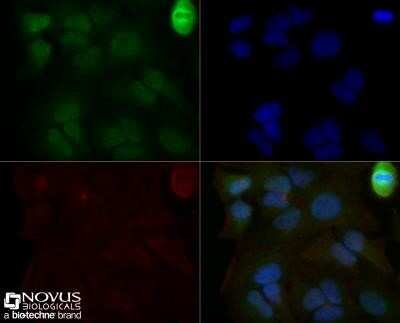 Immunocytochemistry/ Immunofluorescence: Mre11 Antibody (15B8.1E7.6) - Azide and BSA Free [NBP2-80856]