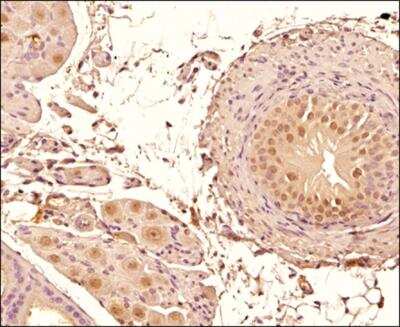 Immunohistochemistry-Paraffin: Mre11 Antibody (15B8.1E7.6) - BSA Free [NBP2-59677]