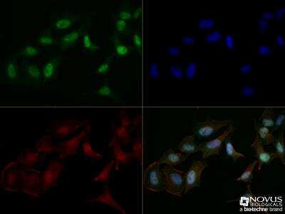 Immunocytochemistry/ Immunofluorescence: Mre11 Antibody [NB100-142]