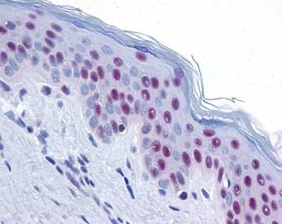 Immunohistochemistry: Mre11 Antibody [NB100-142]
