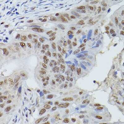 Immunohistochemistry-Paraffin: Mre11 Antibody - Azide and BSA Free [NBP2-95103]
