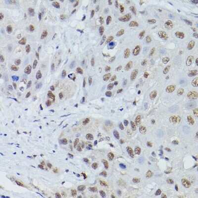 Immunohistochemistry-Paraffin: Mre11 Antibody - Azide and BSA Free [NBP2-95103]
