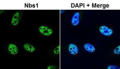Immunocytochemistry/ Immunofluorescence: Mre11-Rad50-NBS1 Complex Antibody Pack [NB100-914]