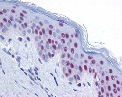 Immunohistochemistry: Mre11-Rad50-NBS1 Complex Antibody Pack [NB100-914]