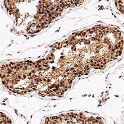 Immunohistochemistry-Paraffin: Mre11-Rad50-NBS1 Complex Antibody Pack [NB100-914]