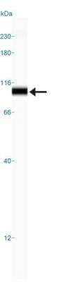 Simple Western: Mre11-Rad50-NBS1 Complex Antibody Pack [NB100-914]