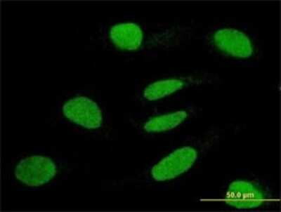 Immunocytochemistry/ Immunofluorescence: MuRF1/TRIM63 Antibody (6G6) [H00084676-M01]