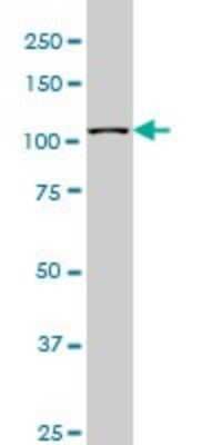 Western Blot: MuSK Antibody (1F3) [H00004593-M01]