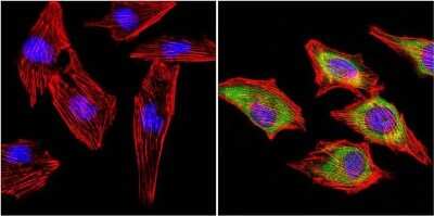 Immunocytochemistry/ Immunofluorescence: MuSK Antibody [NB120-5619]